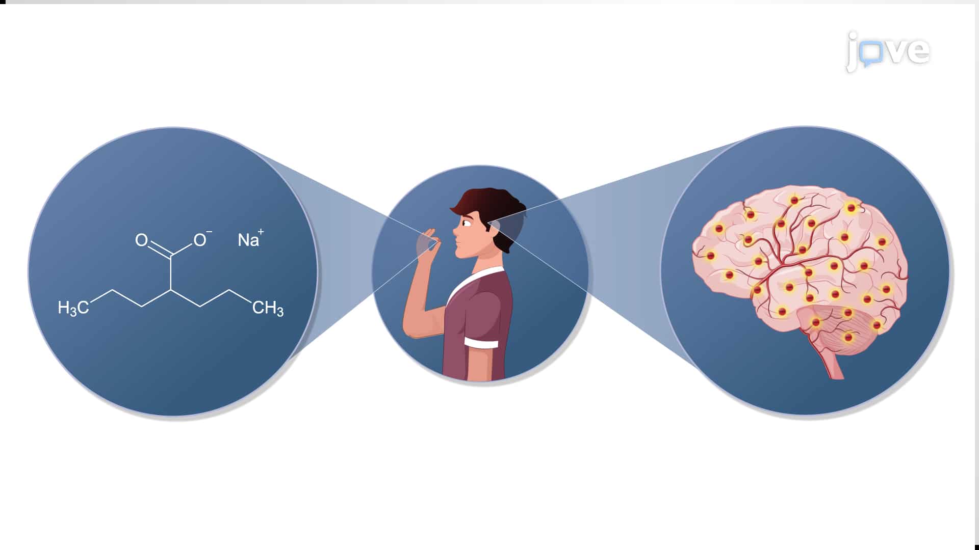 Medicamentos Antiepilépticos: Comparación y Efectos Secundarios